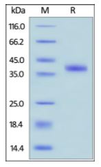 Human R-Spondin 1, His Tag on SDS-PAGE under reducing (R) condition. The gel was stained overnight with Coomassie Blue. The purity of the protein is greater than 95%.